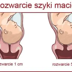 Rozwarcie na 2 palce: ile cm to jest i co oznacza w porodzie?